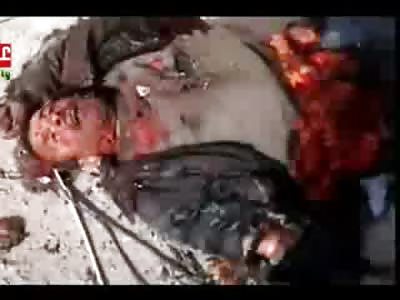 Mans Stomach Ripped Out...Look Bob was Eating Taco's