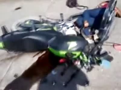 Large Breasted Woman Barley Alive Give her Final Breathe to the Camera