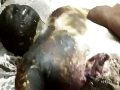 The Insides of the Dead man Fried Up to a Crisp