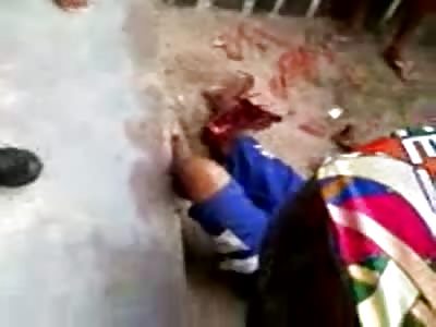 Disgusting Leg Injuries on two Motorcyclists from Horrible Crash