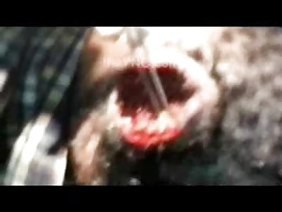 Horrible Infection with Maggots, Worms and All out Grossness Festering in Mans Head