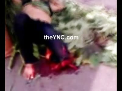 2 Motorcyclists Maimed in Accident both with Legs Ripped Off on the Street 