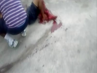 Woman Cries in Agony with her Leg Nearly Ripped off