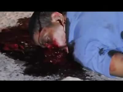 Final Gasping Blood Gurgling Moments After Being Shot in the Head