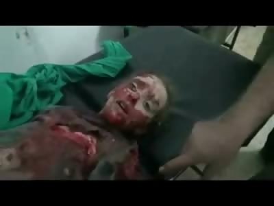 The Saddest Blankest Stare Ever.......and Huge Hole in Her Chest