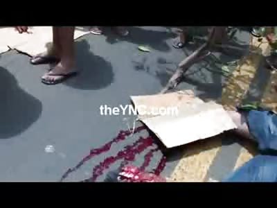 Covered in Cardboard with a Severed Foot, Cringing Man is Comforted by a Few People 