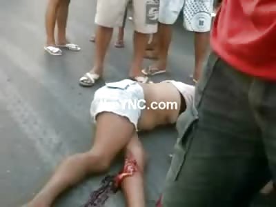 Dying Woman Agonal Breathing on the Street as Onlookers Dial 911