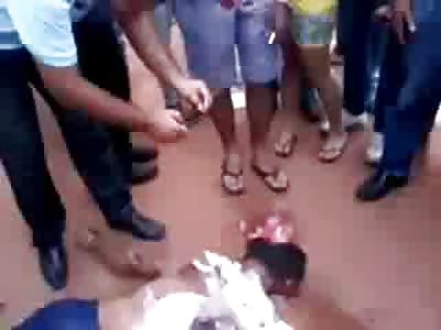 Smeared Man lost his Arm while being Dragged in the Street