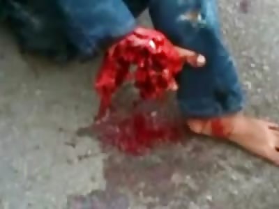 Horrific and NO I don't think anyone can Save this Foot 