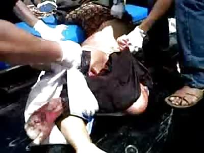 Man's Torso Held Together by Skin is Loaded on the Gurney for Removal