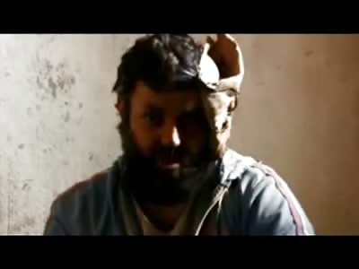 FSA Commander gets his Eye Gouged out....