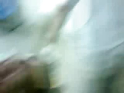 Man with Disfiguring Facial Injury after a Horrible Motorcycle Accident 