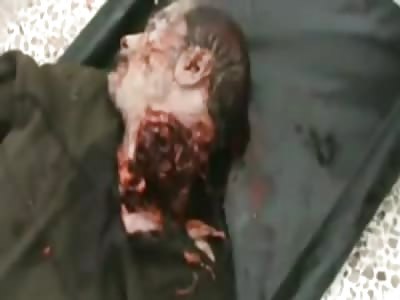 JUST A FLESH WOUND: Half his Neck Gone after Battle