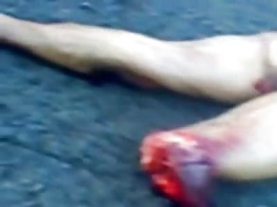 Naked Man with his Head Folded under his Arm 