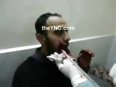 Open Up and Say AHHHHH.....