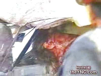 Accident leaves a Man without his Head