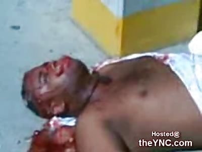 Dying Man vomiting Blood