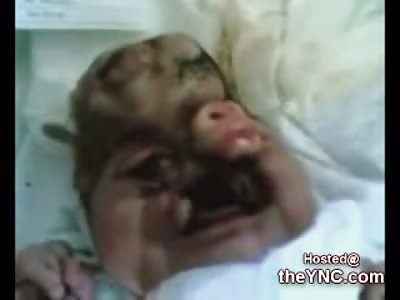 Horrific Birth Defect