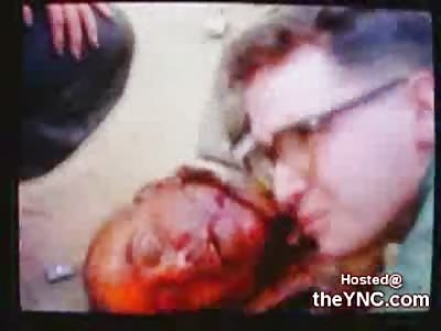 Rare video shows Fatally injured US Soldiers in Vietnam