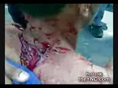 Man hacked up by a Machete