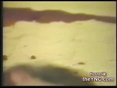 Graphic Aftermath of a Self Inflicted Gunshot to the Head