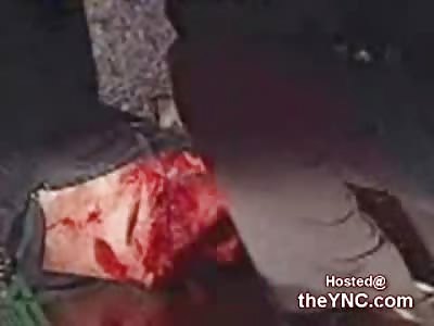 Murder Victim with no Head, no Arms and no Legs