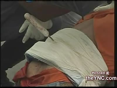 Guy Stabbed in the Back on the Streets of Brazil