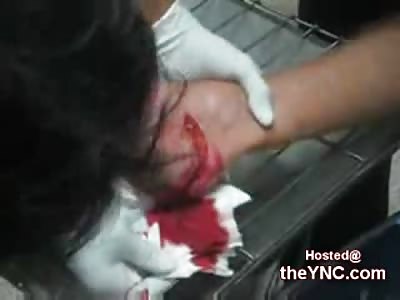 Man has his Foot sliced in Half after trying to stop a Moped