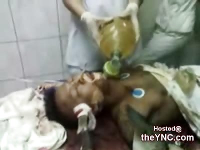 Man with a Knife right through his Head