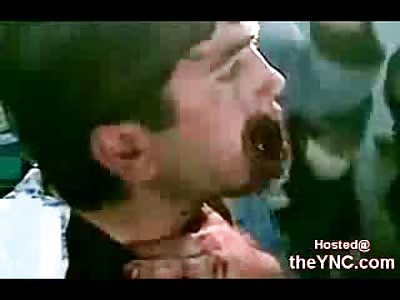 Graphic Video of a Man with a Large Bullet Wound to the Mouth