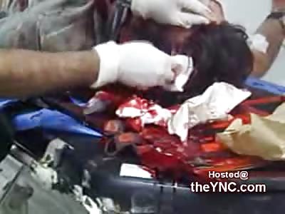 Man with a Gaping and Horrific Head Wound gets it stuffed in the ER