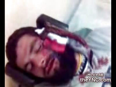 Iron Hook to the Brain