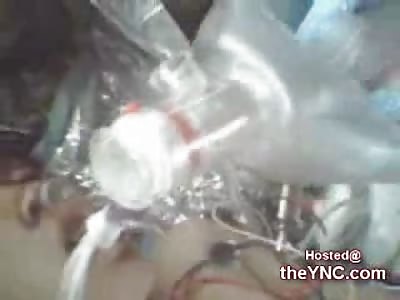 10 Year Old Afghan Boy dies on a Medevac Flight (Graphic 18+ Only)