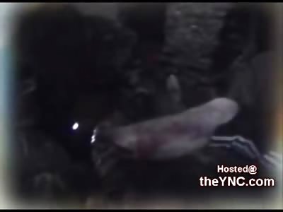 Graphic New Video from Chechnya shows a Leg Amaputation of an Awake Mujahideen