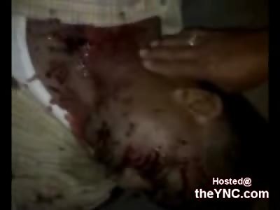 Unlucky Man kicked to Death by a Horse