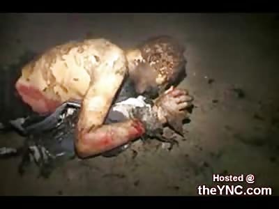 Man Almost Burns to Death in a Car Fire Accident