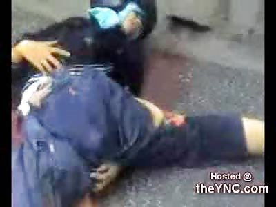 Kids Legs left Twisted & Dangling as He Struggles to Live after Getting Hit By a Car