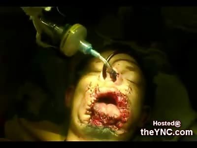 Theif in Russia survives an Attempted Shotgun Suicide