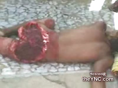 Horrific Shark Attack leaves a Man with his Ass chewed off