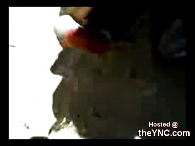 Guy Gets His Toe Shot off