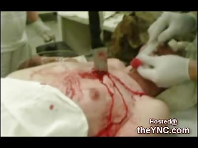 Horrific Images of a Suicide by Knife to the Heart