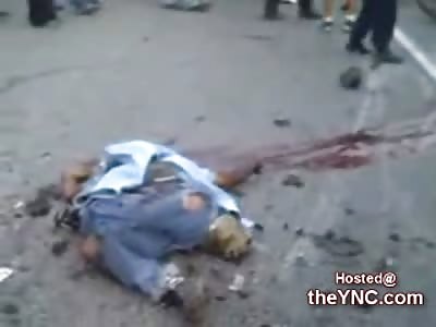 Man hit by Three Different Cars is left Unrecognizable