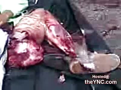 Biker ripped in Half ready to be Zipped Up