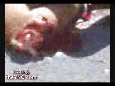 Young Girl Fatally Injured lies on the Street with her Leg Ripped Open