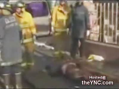 Shocking and Gory Accident leaves a Jamaican Woman Limbless but still Coherent (Very Graphic 18+)