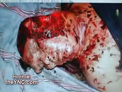 Fisherman who Fell Asleep and was Eaten Alive by Wildlife