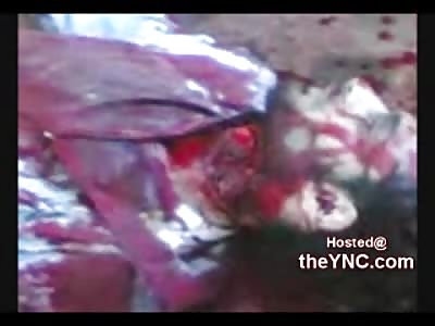 Suicide by Slit Throat and Gasping for Air