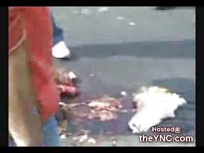 Horrific Accident opens a Man's Head WIDE Open (Extremely Graphic 18+ Only)