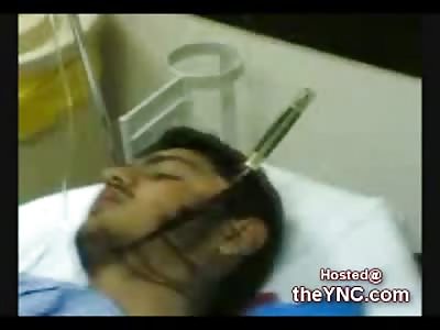 Knife Dragged into the Skull