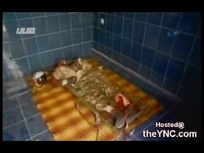 The Remains of a Georgian Pilot shot Down by Russian Military